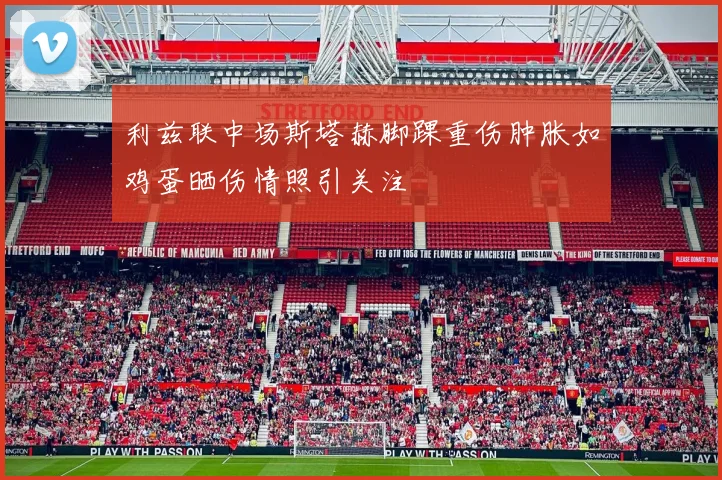 利兹联中场斯塔赫脚踝重伤肿胀如鸡蛋晒伤情照引关注